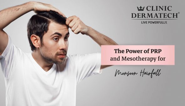 The Power of PRP and Mesotherapy for Monsoon Hairfall