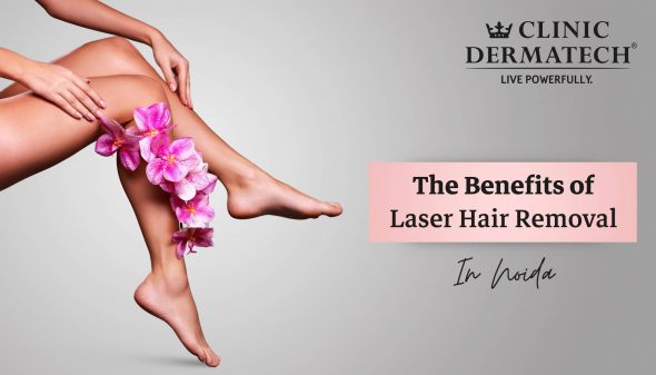 The Benefits Of Laser Hair Removal In Noida