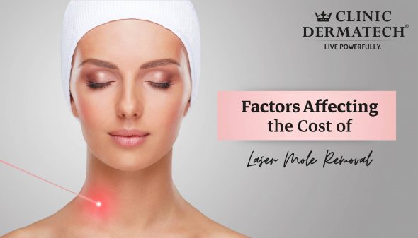 Factors Affecting the Cost of Laser Mole Removal
