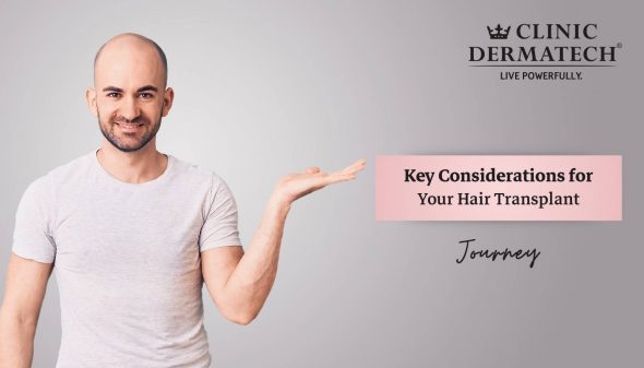 Key Considerations for Your Hair Transplant Journey