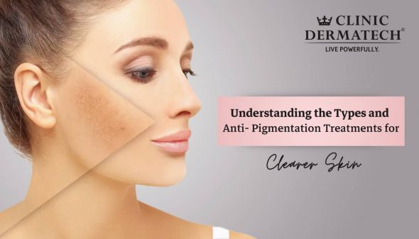 Understanding the Types and Anti- Pigmentation Treatments for Clearer Skin
