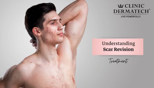 Understanding Scar Revision Treatment