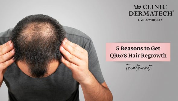 5 Reasons to Get QR678 Hair Regrowth Treatment