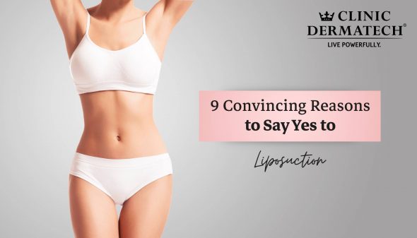9 Convincing Reasons to Say Yes to Liposuction