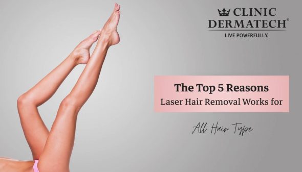 The Top 5 Reasons Laser Hair Removal Works for All Hair Type