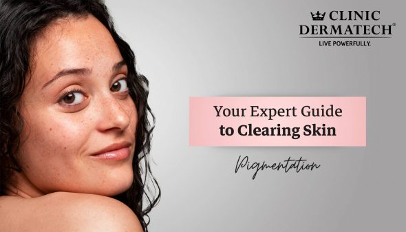 Your Expert Guide to Clearing Skin Pigmentation