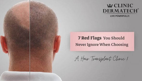 7 Red Flags You Should Never Ignore When Choosing a Hair Transplant Clinic