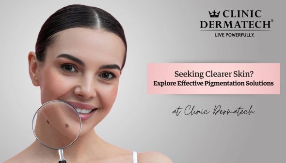 Seeking Clearer Skin? Explore Effective Pigmentation Solutions at Clinic Dermatech