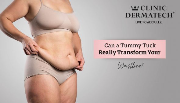Can a Tummy Tuck Really Transform Your Waistline?