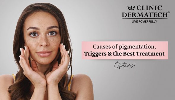 Causes of pigmentation, Triggers & the Best Treatment Options!