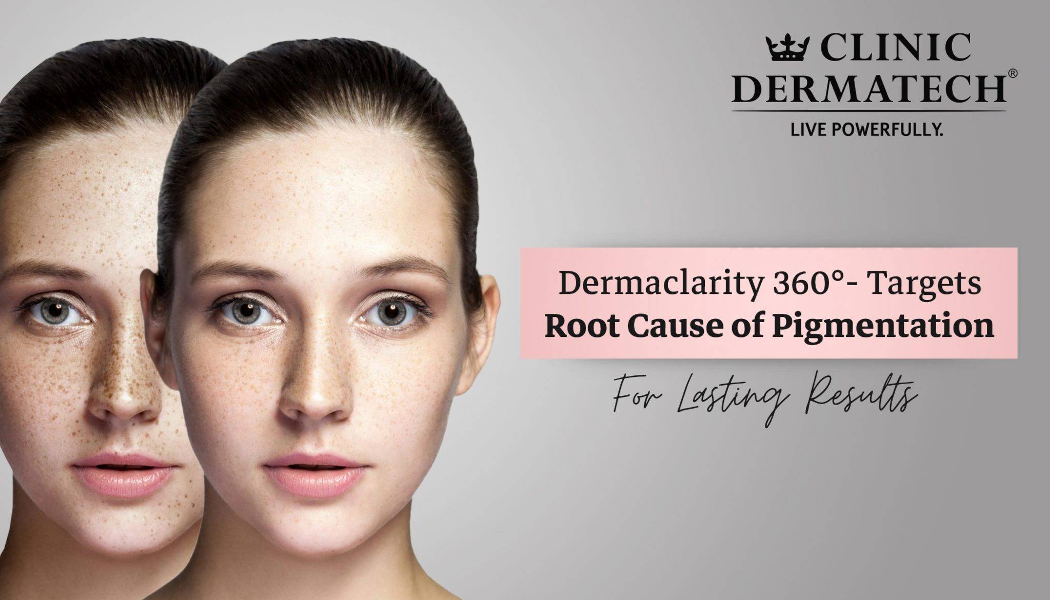 Derma Root Reviews Dermaclarity 360°- Targets Root Cause of Pigmentation for Lasting Results