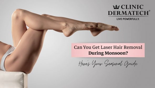 Can You Get Laser Hair Removal During Monsoon? Here’s Your Seasonal Guide