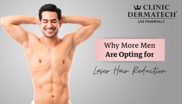 Why More Men Are Opting for Laser Hair Reduction