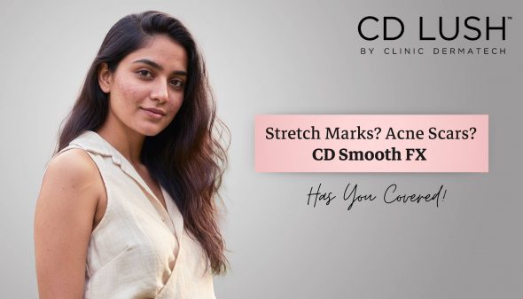 Stretch Marks? Acne Scars? CD Smooth FX Has You Covered!