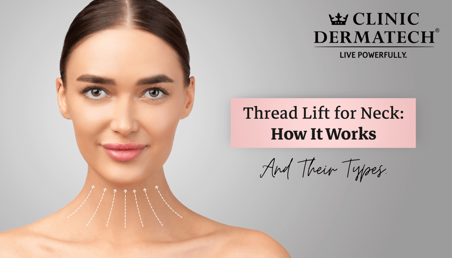 Thread Lift for Neck: How It Works & Its Types.