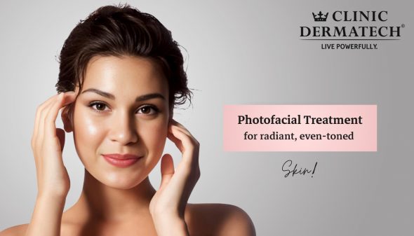 Photofacial Treatment For Radiant, Even-Toned Skin