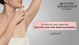 20 Years of Laser Expertise: Your First Laser Hair Reduction Session, Explained!