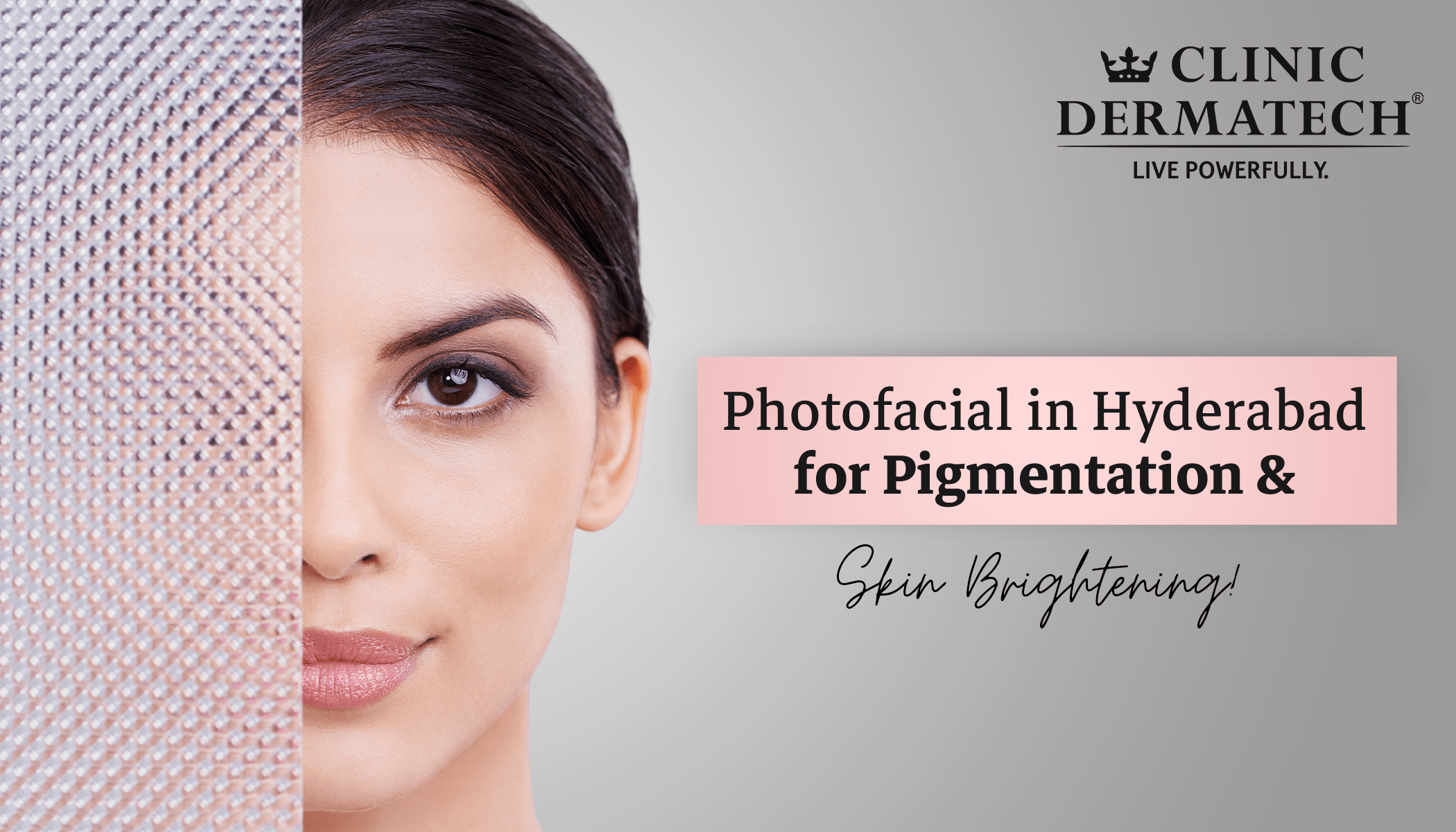 "Photofacial Treatment in Hyderabad, photofacial in Hyderabad, Benefits of Photofacial Treatment, Photofacial Cost in Hyderabad , IPL photofacial in Hyderabad, best photofacial Hyderabad , "