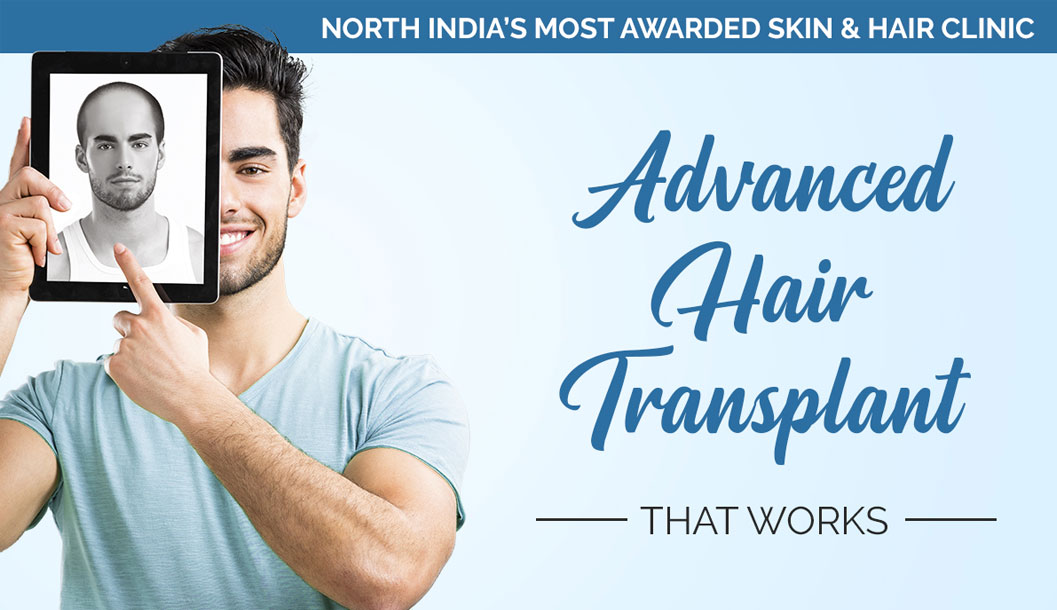 Hair Transplant procedure