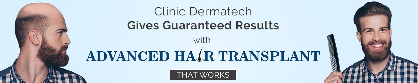 Hair Transplant