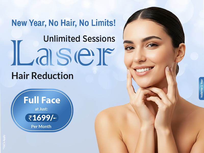 Unlimited session laser